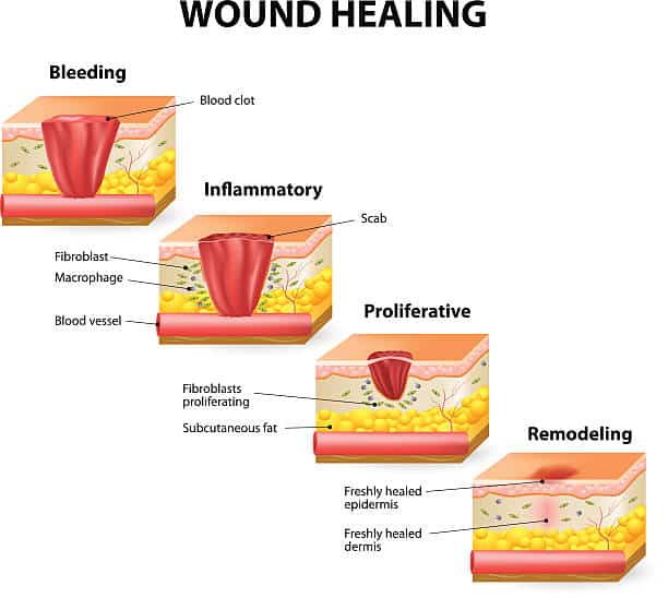 Collagen tripeptide treatment appears to be an effective for wound healing